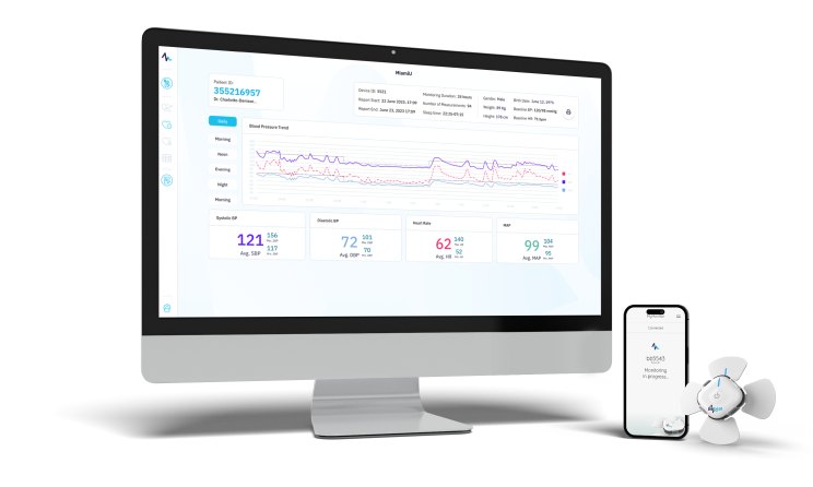 graphs on screen